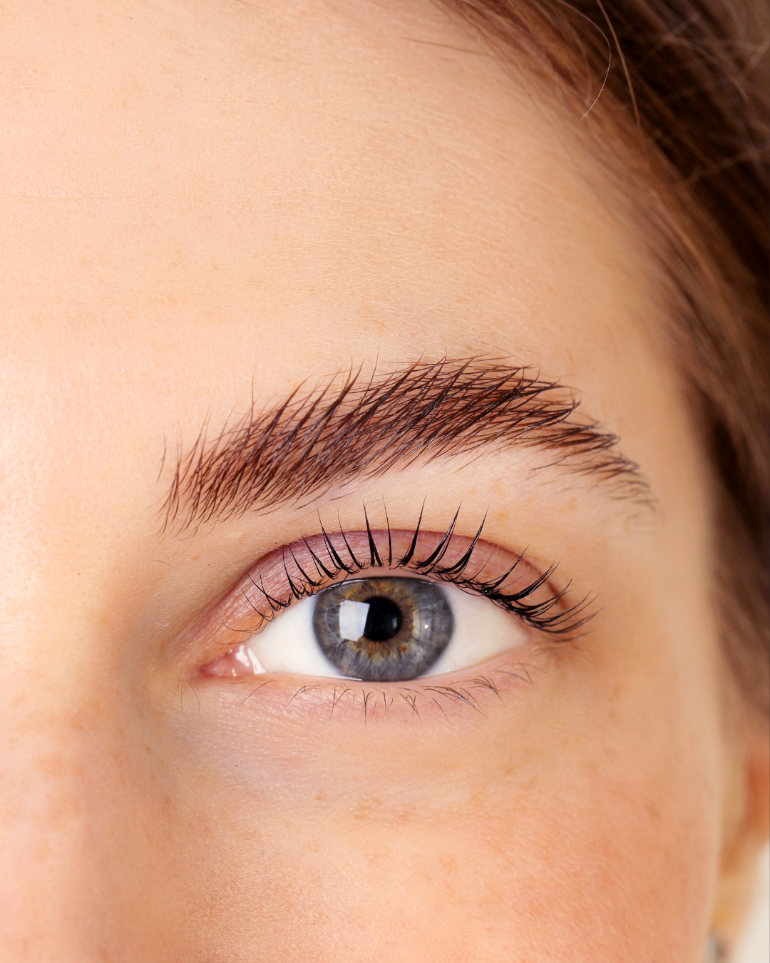 Remove Pigmentation Be Beauty